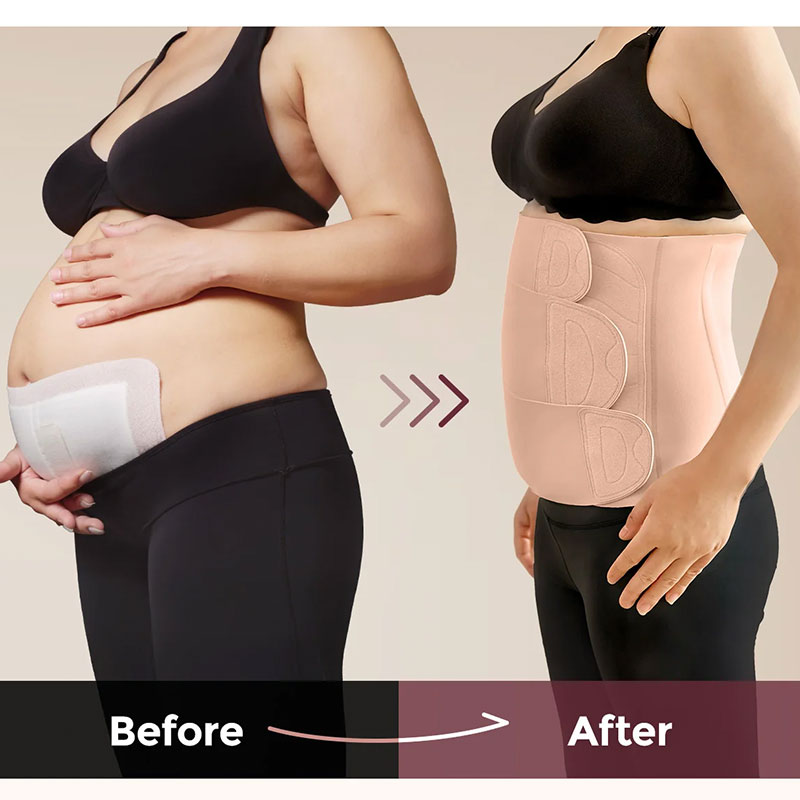 Колан за след раждане Momcozy Ergowrap™